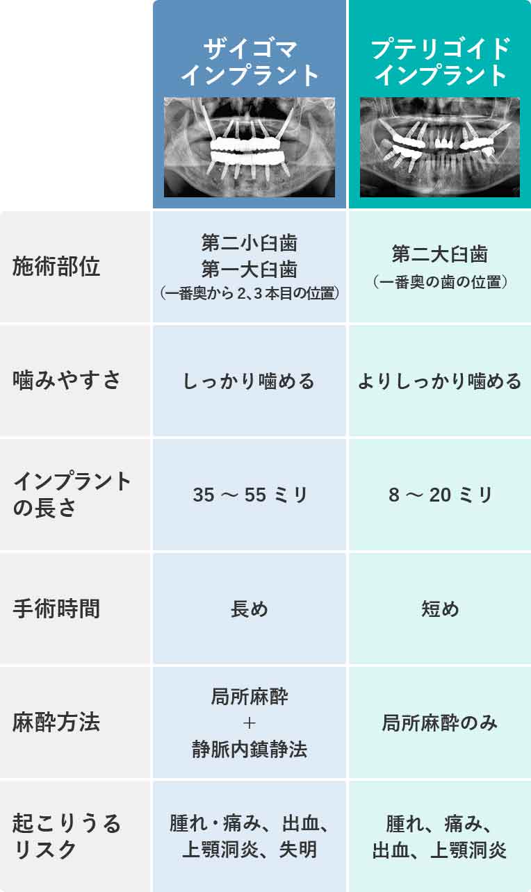 プテリゴイドインプラントとザイゴマインプラントの比較